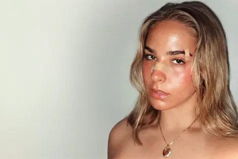 Julia Pośnik z plastrem na nosie i lekkim rumieńcem na policzkach, z błyszczącymi ustami i złotym wisiorkiem na szyi.