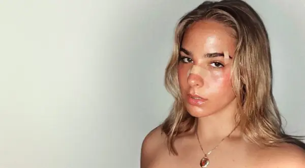 Julia Pośnik z plastrem na nosie i lekkim rumieńcem na policzkach, z błyszczącymi ustami i złotym wisiorkiem na szyi.